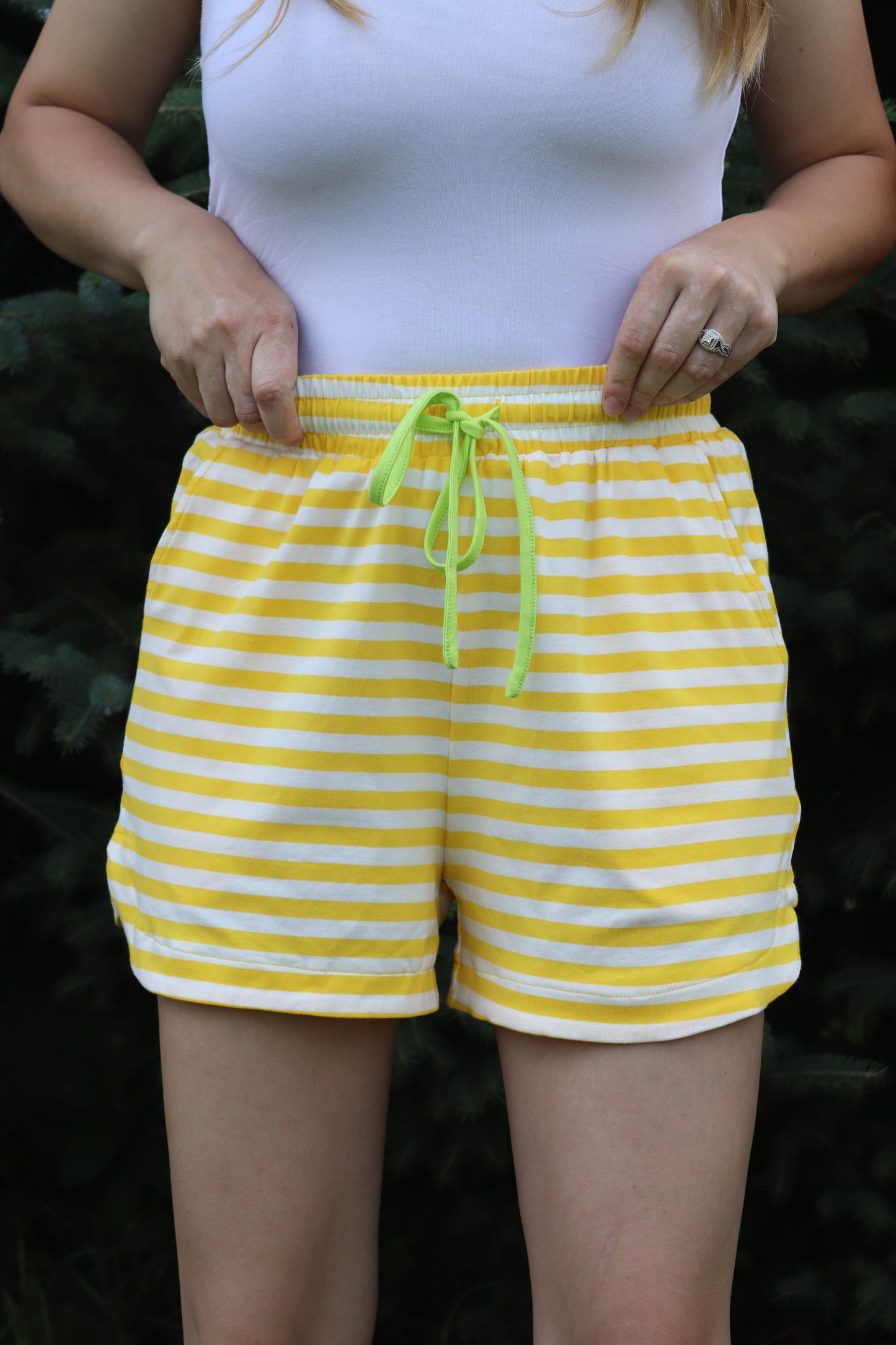 Yellow Striped Set