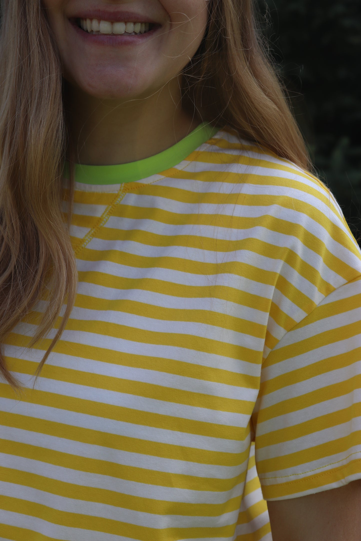 Yellow Striped Set